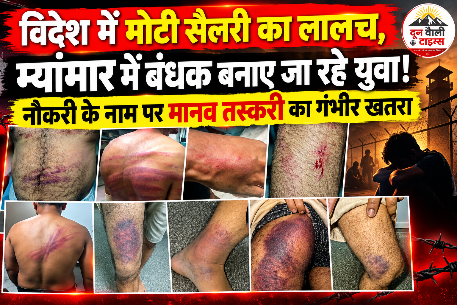 विदेश में मोटी सैलरी का लालच, म्यांमार में बंधक बनाए जा रहे युवा! नौकरी के नाम पर मानव तस्करी का गंभीर खतरा